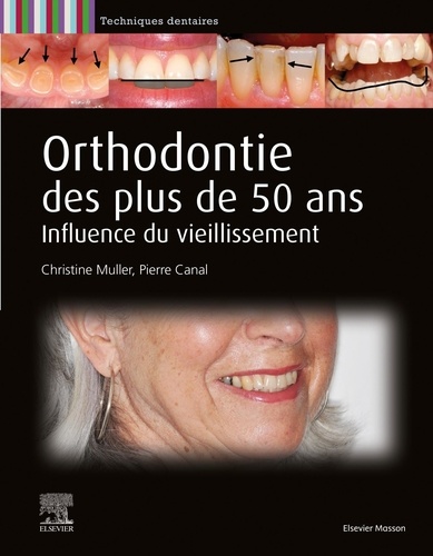 Orthodontie des plus de 50 ans. Influence du vieillissement