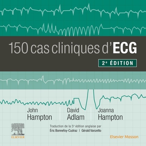 150 cas cliniques d'ECG. 2e édition