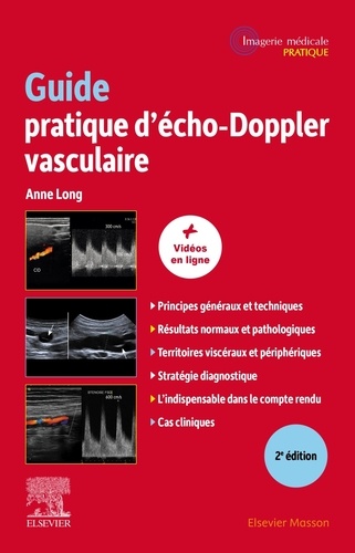 Guide pratique d'écho-Doppler vasculaire. 2e édition